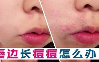 哈喇子成人围嘴视频,趣味视频展现成人围嘴新潮流