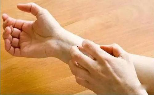 成人湿疹艾灸治疗视频大全,视频大全解析